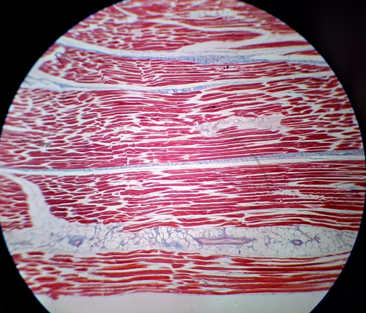 FICHE TP/TD Tissus Musculaire & Nerveux 