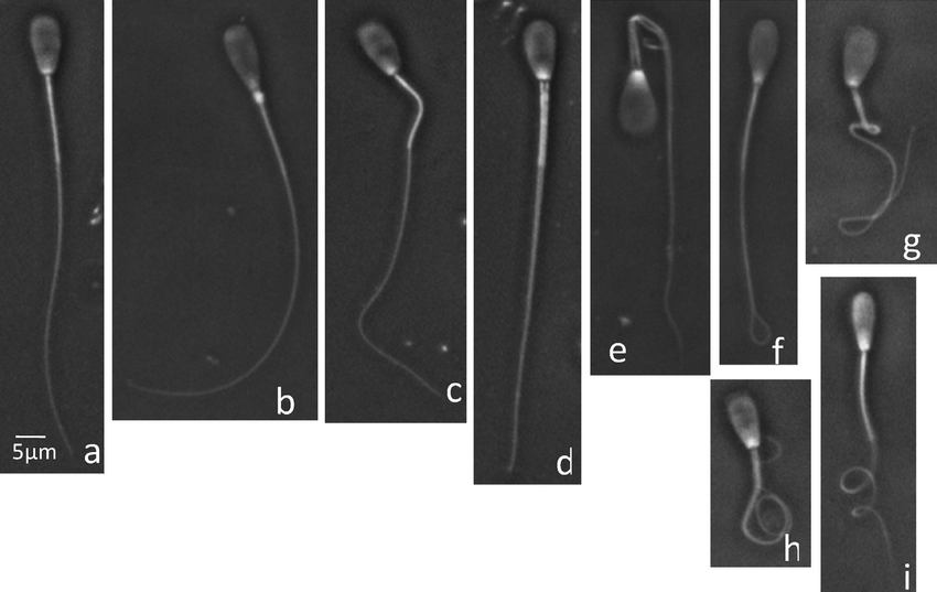 Semen analysis Practical Work