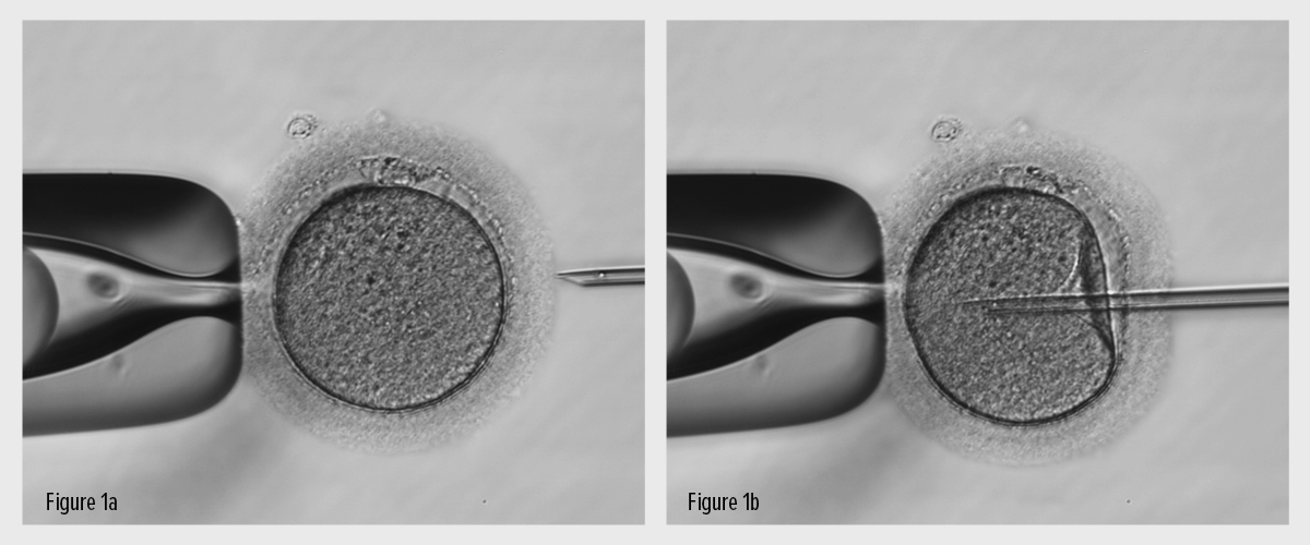 Contraception & assisted reproductive technologies (ART) Practical Work