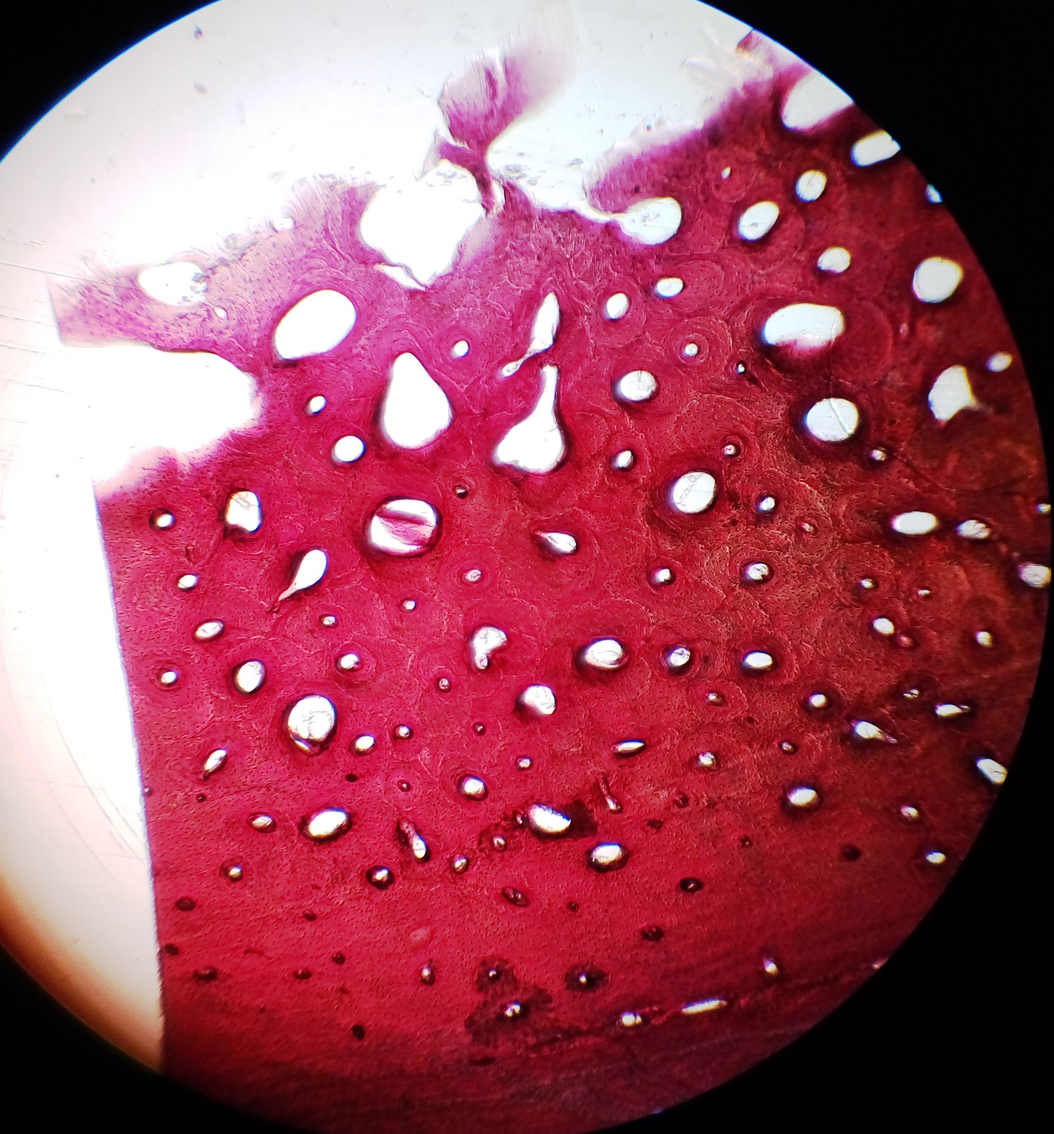 Practical Work 4: Bone tissue